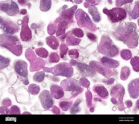 Mycoplasma genitalium, coloured transmission electron micrograph (TEM ...