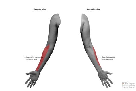 Lateral Antebrachial Cutaneous Nerve | Peripheral Nerve Surgery ...