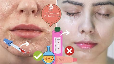 How to Chemically Exfoliate Effectively WITHOUT RUINING YOUR SKIN ...