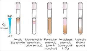 Aerobes and Anaerobes - Microbiology - Medbullets Step 1