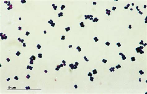 Gram-Positive Cocci - Microbiology learning: The "why"ology of ...