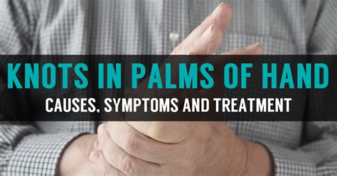 Knots and Lump in Palm of Hands | Symptoms & Home Treatment