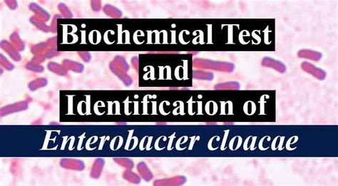 Biochemical Test Chart For Identification Of Bacterial Cells - Home ...