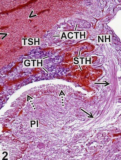 Showing dense population of prolactin cells (PRL) (arrow heads ...