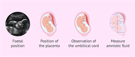 Fetal ultrasound in the third trimester of pregnancy