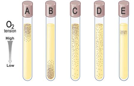 Which of the tubes contains facultative anaerobes? | Homework.Study.com