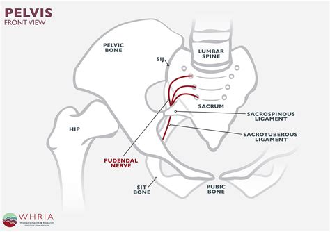 tratamentos para prostatite: Neuralgia do Pudendo (Síndrome da Dor ...