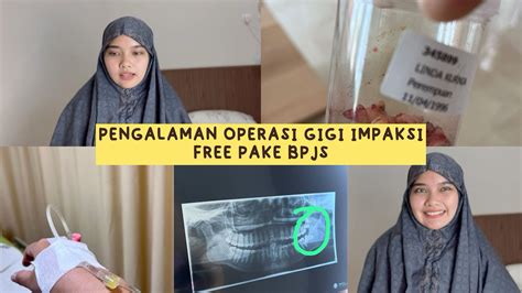 Bagi yang ingin melakukan operasi gigi impaksi yuk di simak.