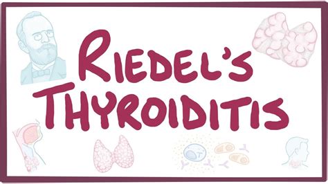 Riedel thyroiditis: Video, Anatomy & Definition | Osmosis