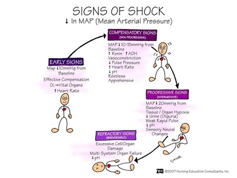 signs of shock | Nursing mnemonics, Nursing school survival, Nurse