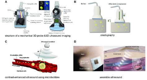 Ultrasound technology applications in medicine. (A) (See in Figure 1 in ...