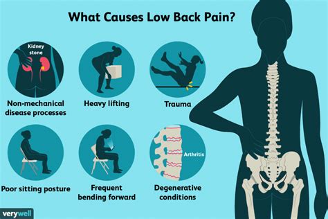 Sciatica | Lumbar Disc | Back Pain Treatment | The Pain Relief Practice