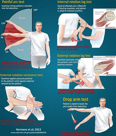 Testing for a possible rotator cuff tear | Rotator cuff, Rotator cuff ...