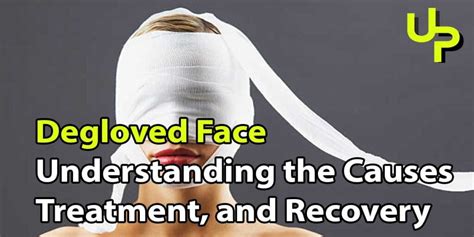 Degloved Face: Understanding the Causes and Treatment