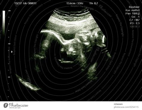 Ultrasound of baby in a mothers womb - a Royalty Free Stock Photo from ...