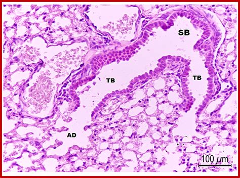 Histological Characteristics of the Tracheobronchial Tree of the Least ...