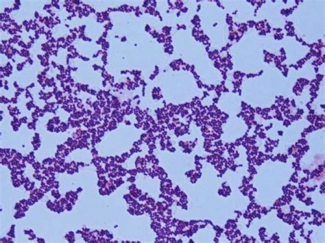 Gram Positive Cocci In Clusters Staph Aureus