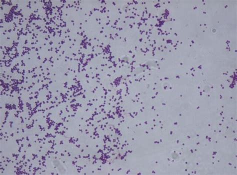 Staphylococcus Saprophyticus Colony Morphology