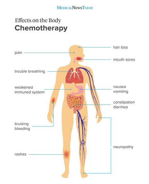 Winning the Fight to Reduce Cancer Treatment Side Effects | Health ...