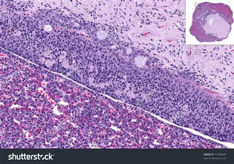 Pituitary Gland Anatomy Stock Photo 71338543 | Shutterstock