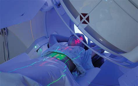 Stereotactic Body Radiation Therapy: A New Paradigm for Radiation ...