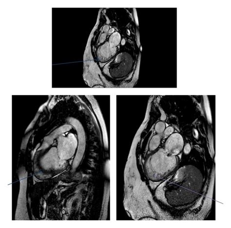 Cine MRI, morphology, phase-contrast, and contrast cardiac MRI ...