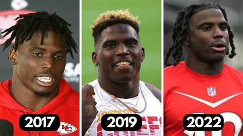 The Tyreek Hill Dreads Evolution | Heartafact