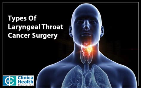 Types Of Laryngeal Throat Cancer Surgery