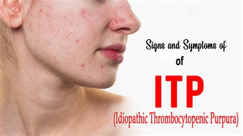 Signs and Symptoms of Idiopathic Thrombocytopenic Purpura (ITP ...