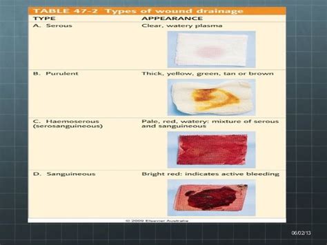 Serosanguinous Vs Serous