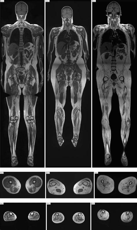 MRI Scans – SWC Healthcare