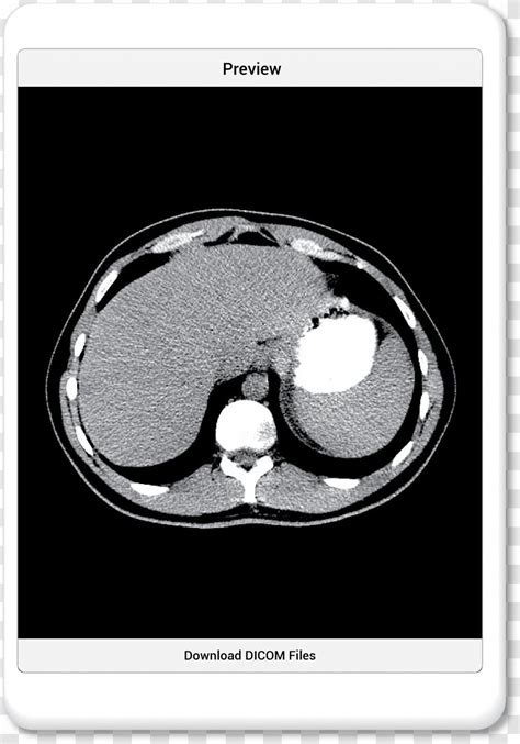 Medical Imaging Computed Tomography PocketSix Technologies Inc. .com ...