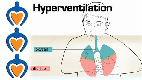 Hyperventilation - Causes and treatment of hyperventilation - YouTube