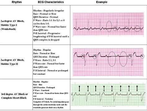 Pin by Saving American Hearts, Inc. on Saving American Hearts, Inc. AHA ...