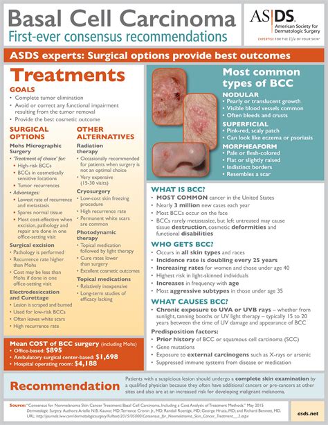 ASDS Releases Consensus Recommendations on Basal Cell Carcinoma