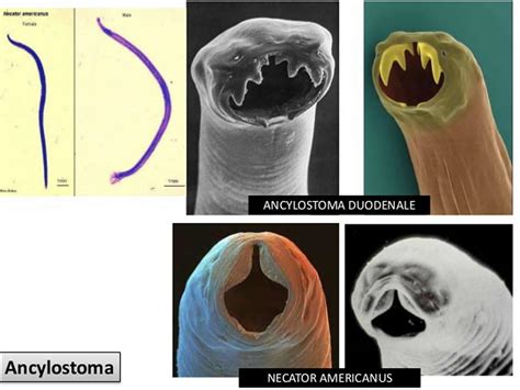 Hookworm infection, symptoms, diagnosis & hookworm treatment in humans