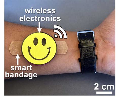 Low-cost “smart bandages” wirelessly monitor open wound status ...