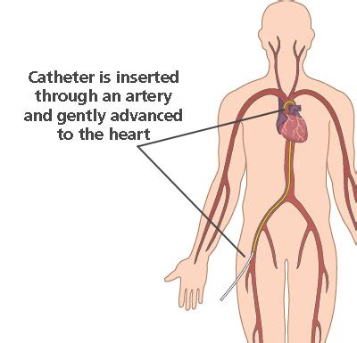 🌈 Ephemeral artery. ephemeralartery. 2022-10-24