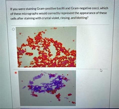 Ifyou were staining Gram-positive bacilli and Gram-negative cocci ...