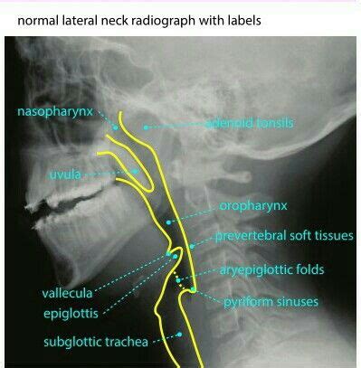 lateral neck radiograph - usaha atau bisnis yang menjanjikan