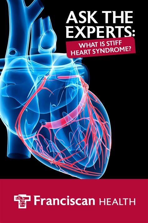 What Is Stiff Heart Syndrome? | Franciscan Health