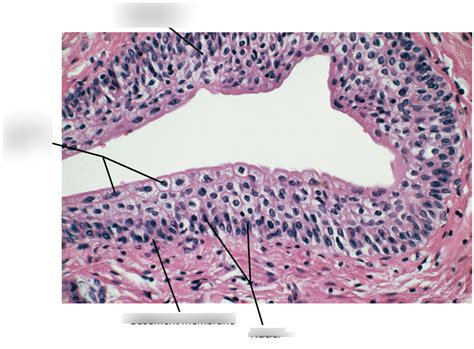 Exam 3 - Histology Transitional epithelium, urinary bladder; cross ...