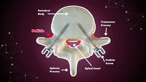 Vertebral Pedicles: Anatomy, Function, and Spine Surgery | Ruthless Spine