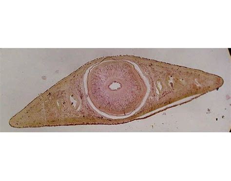 Planaria XS through Pharynx Quiz