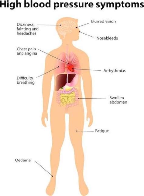 High Blood Pressure (HBP)/ Hypertension: Symptoms, Complications, and ...