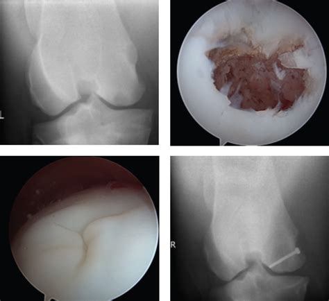 A Look At Hind Limb Lameness | InStrideEdition