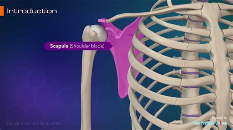 Scapula Fracture Video | Medical Video Library