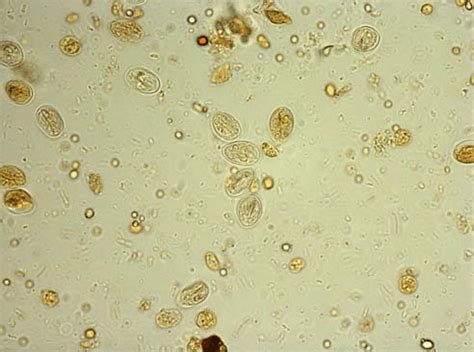 Giardia Lamblia In Stool