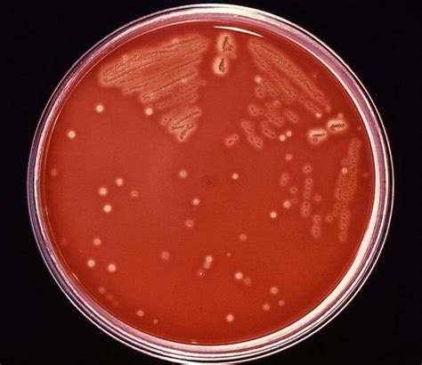 Streptococcus pyogenes- Group A Streptococcus (GAS)- An Overview