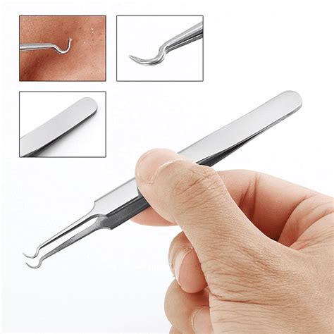 GLiving Professional Surgical Blackhead Remover Comedone Extractor ...